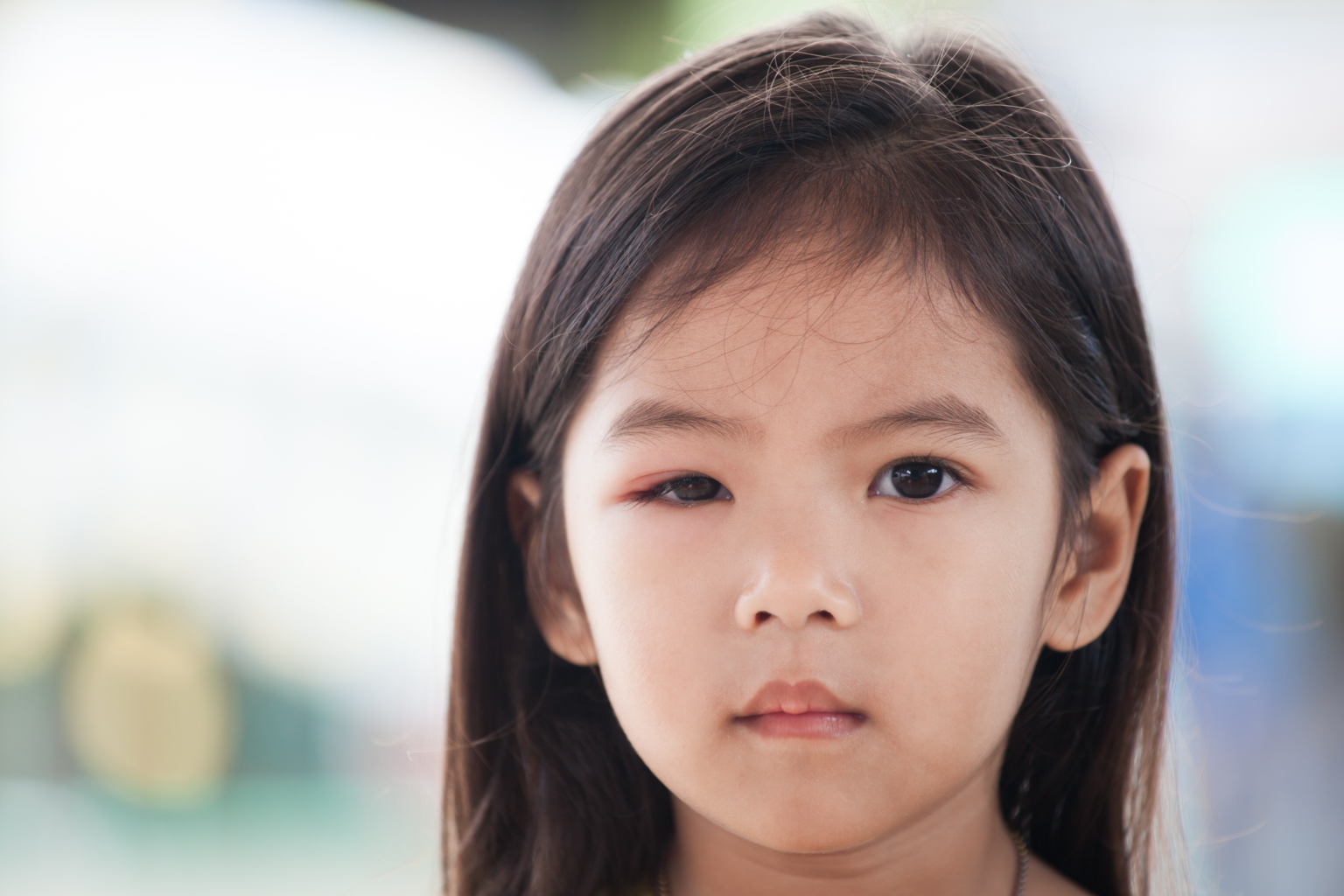 4-common-health-problems-in-children-to-look-out-for-kiddocare